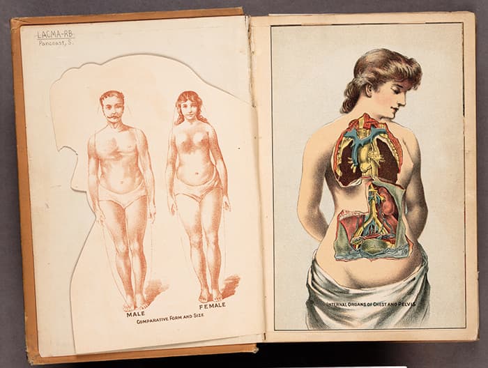 19th century medical illustration of woman
